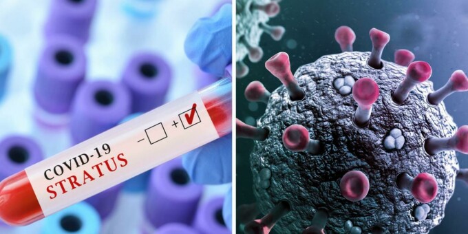 В Беларуси зафиксирован новый штамм коронавируса «Стратус», сообщает Минздрав. Хорошо не страус